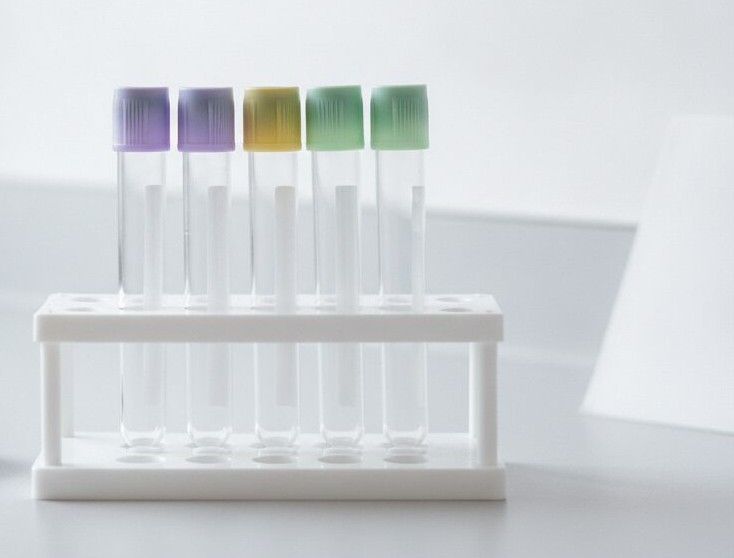 Five clear glass blood collection tubes with two lavender, one yellow and two green caps stand in a white rack on a white lab counter.